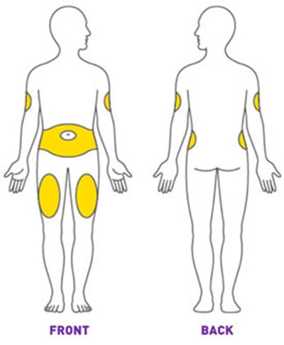 Figure (Trulicity Ifu 0point75 Injection Sites V1)