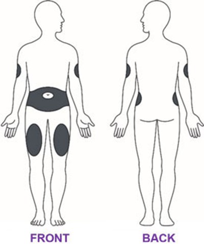 Figure (Trulicity Ifu 3mg Injection Sites V1)