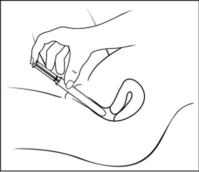 Figure-f (Figure F)