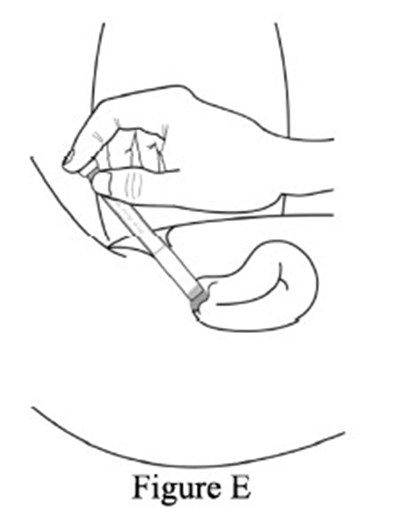 Image E (Image E)