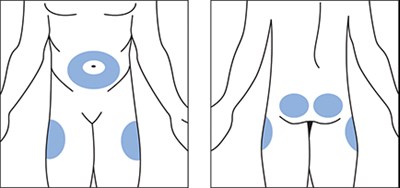 Fig Rr (Image 19)