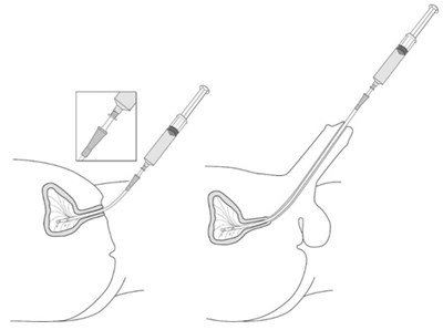Figure 11 (Cysview 12)