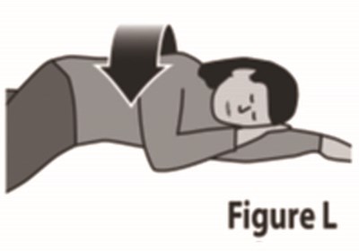 Figure L (Rezenopy Naloxone HCl Nasal Spray 15)