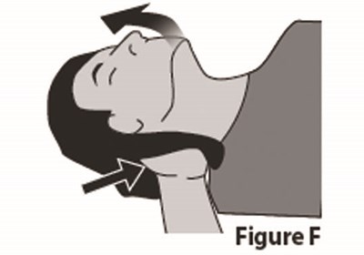 Figure F (Rezenopy Naloxone HCl Nasal Spray 9)