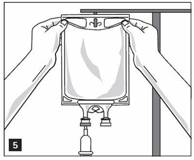 Illustration 6 (Sodium Chloride Irrigation In Titan 6)