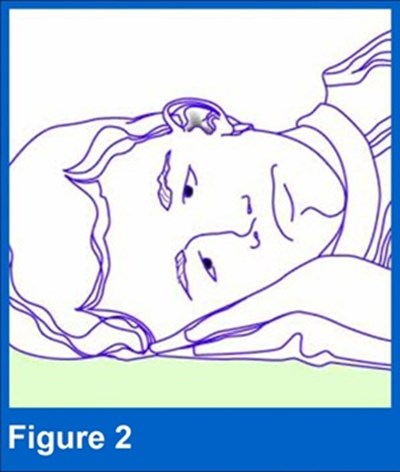 Figure 2 (Figure2)