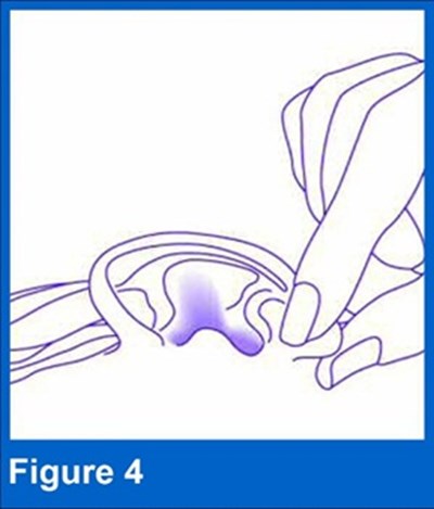 Figure 4 (Figure4)