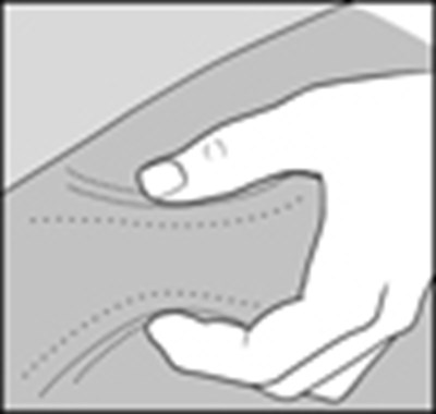 Figure_f (Glatopa Image 11)