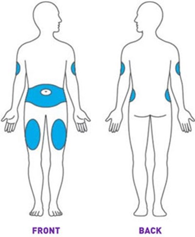 Figure (Trulicity Ifu 1point5 Injection Sites V1)
