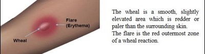 Length_and_Midpoint_Orthogonal_Width.jpg Length and Midpoint Orthogonal Width