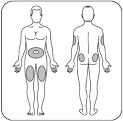 Figure (Lyumjev Inj Sites V1)