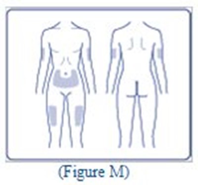 200 U/ml Ifu Figure M (Image 57)