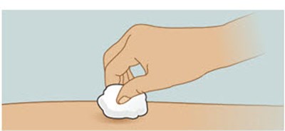 Step 10 - adalimumab 17