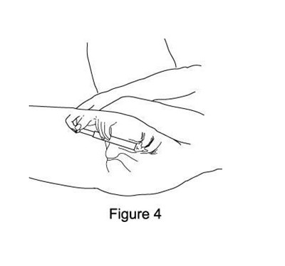 Figure 4 (F4)