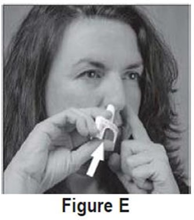 fige - sumatriptan nasal spray usp 8