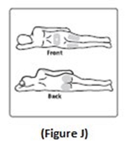 Figure J (39c679b5 960c 4c65 8306 2cbb6a9469b2 17)