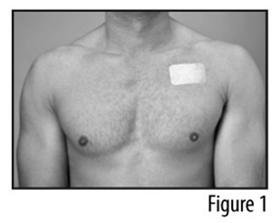 Figure 1 (Patch applied to chest)