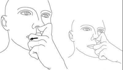 Figure F (Nat07 0000 11)