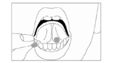 Ifu-image (Buprenorphine Sublingual Tablets Ifu Image)