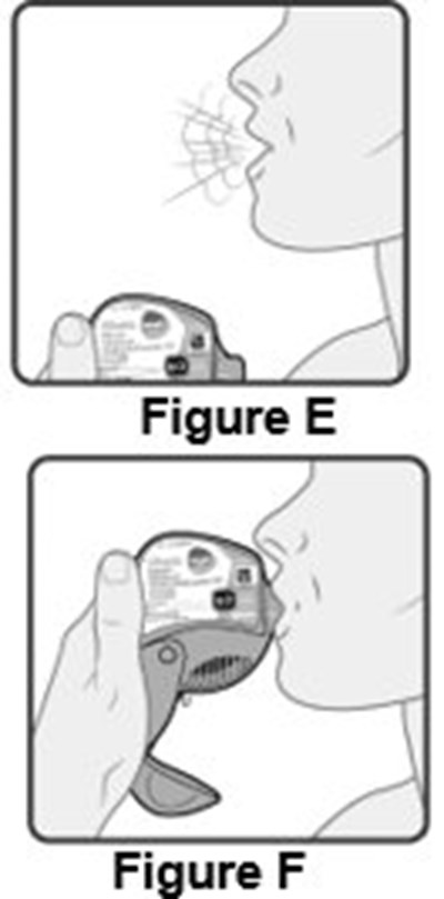 Instructions For Use Figures E And F (Image 12)