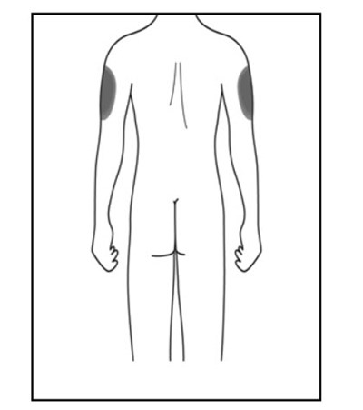 Figure F (Omb157g 09)