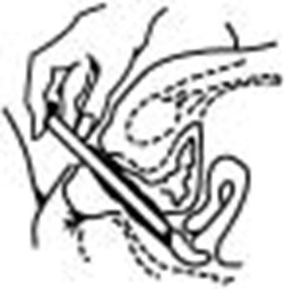 Figure (Terconazole 4 04)