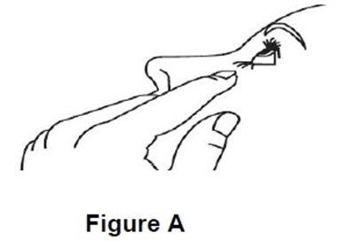 Fig-a (Fig A)
