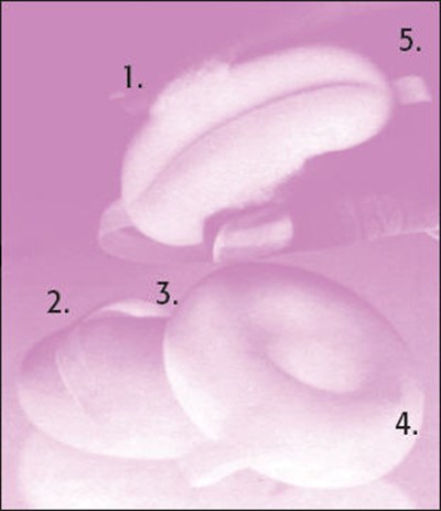 Figure (Today 02)