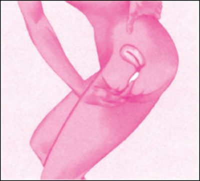Figure (Today 11)