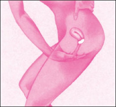 Figure (Today 12)