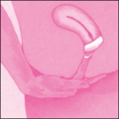 Figure (Today 13)