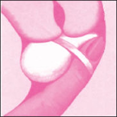 Figure (Today 15)