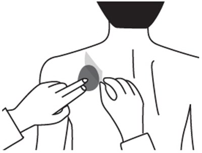 Figure E (Rivastigmine 14)