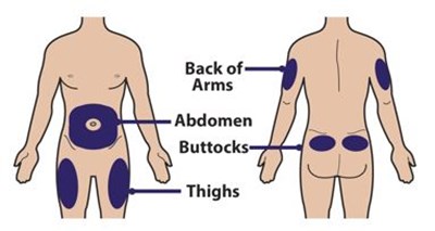 Figure I - palynziq 10