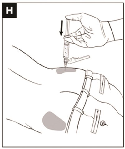 Figure H (Naltrexone For Extended Release Injectable Suspens 8)