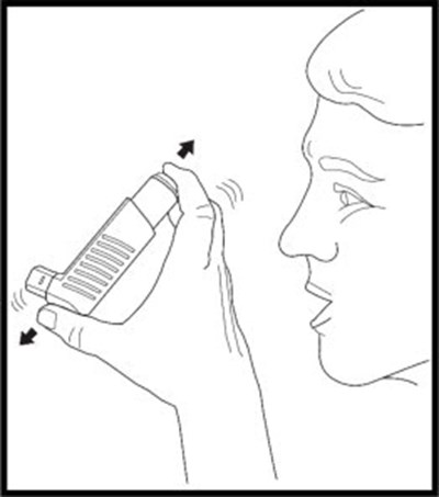 Figure 4 - xop04 0024 10a