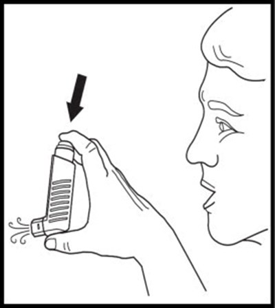 Figure 5 - xop04 0024 11a