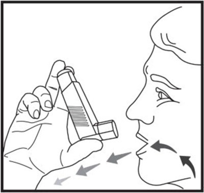 Figure 6 - xop04 0024 12a