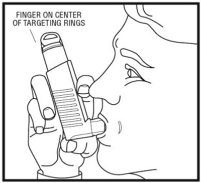 Figure 7 - xop04 0024 13a