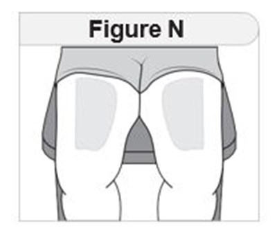 Figure N (Imcivree 16)