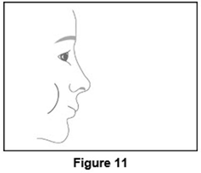 Figure 11 (hold your breath)
