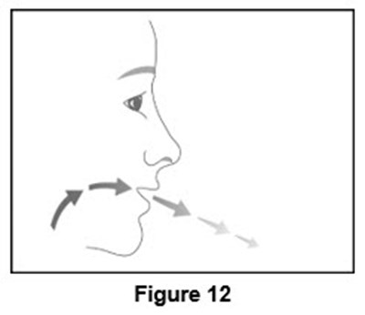 Figure 12 (breath out gently)