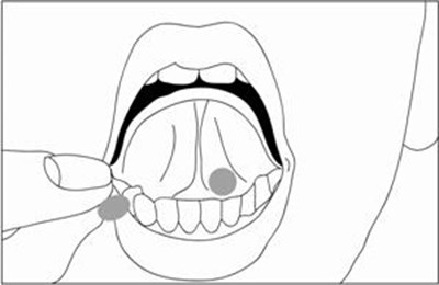 Figure - buprenorphine hydrochloride 2