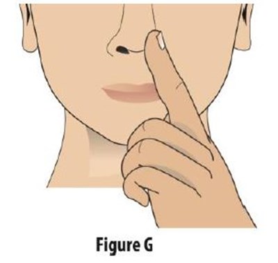 Fig-g (Figureg)