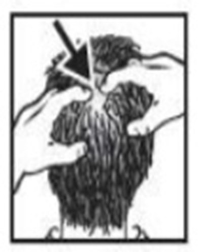 Apply To Scalp Image (Image 05)