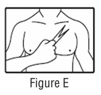 Figure E - figure e
