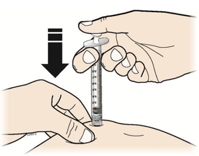 releuko filgrastim ayow injection 25