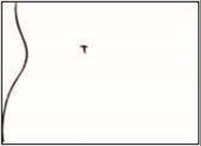3 - dotti estradiol transdermal system 9