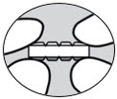 siklos-10.jpg Figure - siklos 10