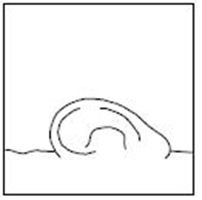 ofloxacin11 - ofloxacin11